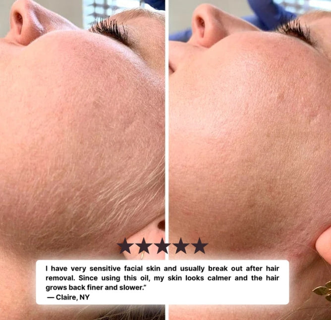 SmoothSilk Hair Removal Oil™